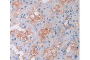 Used in DAB staining on fromalin fixed paraffin- embedded kidney tissue (Amyloid beta Precursor Protein Binding Protein 1 (AA 229-534) antibody)