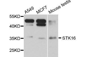 Western blot analysis of extract of various cells, using STK16 antibody. (STK16 antibody)