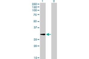 Western Blot analysis of GALNT12 expression in transfected 293T cell line by GALNT12 MaxPab polyclonal antibody. (GALNT12 antibody  (AA 1-272))
