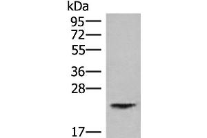 Western blot analysis of Human kidney tissue lysate using HEBP1 Polyclonal Antibody at dilution of 1:750
