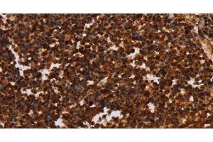 Immunohistochemistry of paraffin-embedded Human tonsil tissue using ALG11 Polyclonal Antibody at dilution 1:40 (ALG11 antibody)