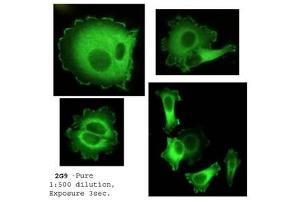 Immunofluorescence (IF) image for anti-Neural Precursor Cell Expressed, Developmentally Down-Regulated 9 (NEDD9) (AA 82-398) antibody (ABIN7278755) (NEDD9 antibody  (AA 82-398))