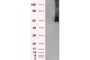 HEK293T cells were transfected with the pCMV6-ENTRY control (Left lane) or pCMV6-ENTRY PLK1 (Right lane) cDNA for 48 hrs and lysed. (PLK1 antibody)