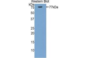 Detection of Recombinant HSPA1L, Human using Polyclonal Antibody to Heat Shock 70 kDa Protein 1 Like Protein (HSPA1L) (HSPA1L antibody  (AA 1-641))