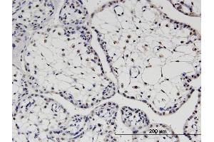 Immunoperoxidase of monoclonal antibody to TBX22 on formalin-fixed paraffin-embedded human placenta. (T-Box 22 antibody  (AA 431-519))