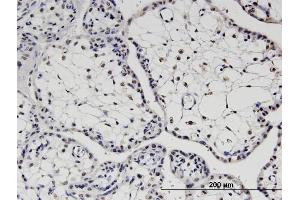 Immunoperoxidase of monoclonal antibody to TBX22 on formalin-fixed paraffin-embedded human placenta. (T-Box 22 antibody  (AA 431-519))