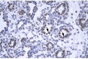 Rabbit Anti-YEATS4 Antibody  Paraffin Embedded Tissue: Human Lung Cellular Data: Alveolar cells Antibody Concentration: 4. (GAS41 antibody  (Middle Region))
