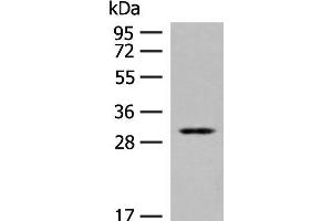 Western blot analysis of Human kidney tissue lysate using TPMT Polyclonal Antibody at dilution of 1:400 (TPMT antibody)