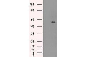 HEK293T cells were transfected with the pCMV6-ENTRY control (Left lane) or pCMV6-ENTRY CNDP1 (Right lane) cDNA for 48 hrs and lysed. (CNDP1 antibody)