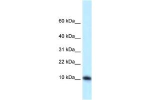WB Suggested Anti-Med21 Antibody   Titration: 1. (MED21 antibody  (N-Term))