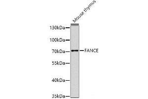 Western blot analysis of extracts of Mouse thymus using FANCE Polyclonal Antibody at dilution of 1:1000. (FANCE antibody)