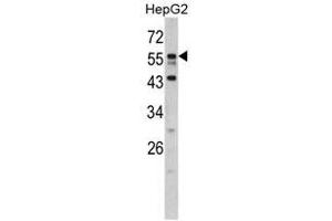 Image no. 1 for anti-Downstream Neighbor of SON (DONSON) (N-Term) antibody (ABIN452922) (DONSON antibody  (N-Term))