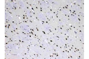 Immunohistochemistry (IHC) image for anti-Mediator Complex Subunit 18 (MED18) (AA 1-208) antibody (ABIN5519036)