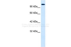 Western Blotting (WB) image for anti-Homeodomain Interacting Protein Kinase 2 (HIPK2) (Middle Region) antibody (ABIN2779735)