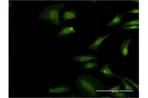 Immunofluorescence of monoclonal antibody to EIF3I on HeLa cell. (EIF3I antibody  (AA 226-325))