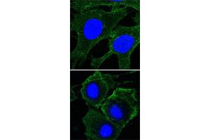 Confocal immunofluorescence analysis of HeLa (upper) and HepG2 (bottom) cells using KDR monoclonal antibody, clone 4B4  (green) .