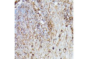 Immunohistochemistry of paraffin-embedded human esophageal using HLA-B antibody (ABIN1513015, ABIN3021868, ABIN3021869 and ABIN6216628) at dilution of 1:100 (40x lens).