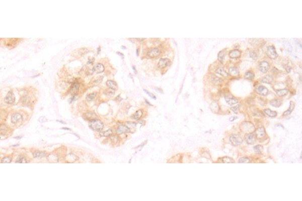 TRMT1 antibody