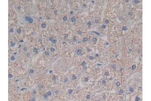 Detection of CCL3L1 in Human Liver Tissue using Polyclonal Antibody to Chemokine C-C-Motif Ligand 3 Like Protein 1 (CCL3L1) (CCL3L1 antibody  (AA 1-93))