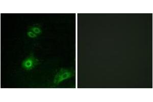 Immunofluorescence analysis of A549 cells, using OR4A16 Antibody. (OR4A16 antibody  (AA 261-310))