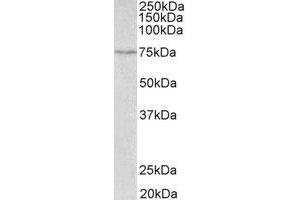 Western Blotting (WB) image for anti-Solute Carrier Family 6 (Neurotransmitter Transporter, serotonin), Member 4 (SLC6A4) (C-Term) antibody (ABIN2465034) (SLC6A4 antibody  (C-Term))