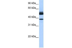 WB Suggested Anti-LIPJ Antibody Titration: 0. (LIPJ antibody  (C-Term))