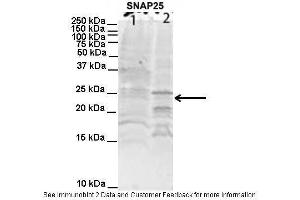 Lanes:   1. (SNAP25 antibody  (C-Term))