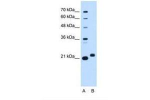 Image no. 1 for anti-Chromosome 1 Open Reading Frame 159 (C1orf159) (AA 93-142) antibody (ABIN6738341) (C1orf159 antibody  (AA 93-142))