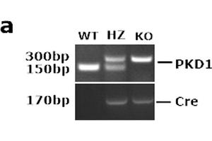 PKD1 was deleted specifically in transgenic mice. (SP7 antibody  (AA 331-431))