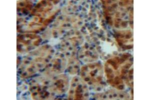 Used in DAB staining on fromalin fixed paraffin-embedded kidney tissue (IGFBP5 antibody  (AA 25-271))