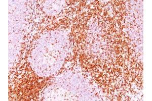 Image no. 2 for anti-CD6 (CD6) antibody (ABIN6160102) (CD6 antibody)