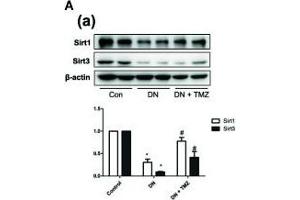 Trimetazidine (TMZ) reduced HFG-induced ROS generation and EMT depending on upregulation of Sirt1. (SIRT1 antibody  (AA 448-747))