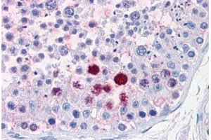Human Testis: Formalin-Fixed, Paraffin-Embedded (FFPE) (ENPP3 antibody  (C-Term))