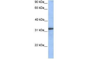 ETFA antibody used at 1 ug/ml to detect target protein.