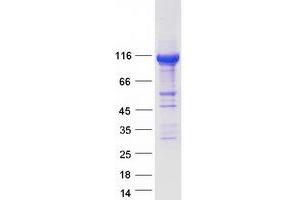 SPATA5 Protein (Myc-DYKDDDDK Tag)