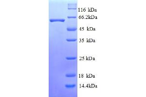 SDS-PAGE (SDS) image for Leucine Rich Repeat and Ig Domain Containing 1 (LINGO1) (AA 37-555) protein (His tag) (ABIN5711887) (LINGO1 Protein (AA 37-555) (His tag))