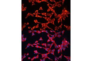 Immunofluorescence analysis of NIH/3T3 cells using GDI2 antibody (ABIN6129647, ABIN6141048, ABIN6141049 and ABIN7101828) at dilution of 1:100. (GDI2 antibody  (AA 296-445))