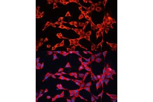 Immunofluorescence analysis of NIH/3T3 cells using GDI2 antibody (ABIN6129647, ABIN6141048, ABIN6141049 and ABIN7101828) at dilution of 1:100. (GDI2 antibody  (AA 296-445))