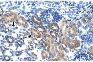 Human kidney; CGI-62 antibody - C-terminal region in Human kidney cells using Immunohistochemistry (FAM164A antibody  (C-Term))