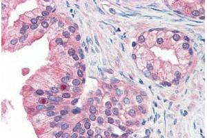 Human Prostate (formalin-fixed, paraffin-embedded) stained with MFI2 antibody ABIN351428 at 15 ug/ml followed by biotinylated goat anti-rabbit IgG secondary antibody ABIN481713, alkaline phosphatase-streptavidin and chromogen. (MFI2 antibody  (N-Term))