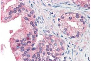 Human Prostate (formalin-fixed, paraffin-embedded) stained with MFI2 antibody ABIN351428 at 15 ug/ml followed by biotinylated goat anti-rabbit IgG secondary antibody ABIN481713, alkaline phosphatase-streptavidin and chromogen. (MFI2 antibody  (N-Term))