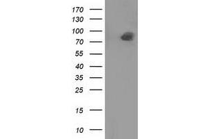 HEK293T cells were transfected with the pCMV6-ENTRY control (Left lane) or pCMV6-ENTRY PTPRE (Right lane) cDNA for 48 hrs and lysed. (PTPRE antibody)