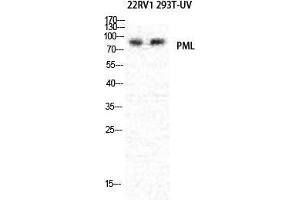 Western Blot (WB) analysis of specific cells using PML Polyclonal Antibody. (PML antibody  (N-Term))