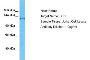 Host: Rabbit Target Name: SFI1 Sample Type: Jurkat Whole Cell lysates Antibody Dilution: 1. (SFI1 antibody  (C-Term))