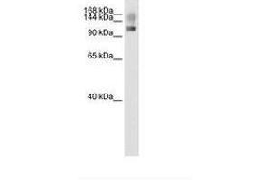 Image no. 1 for anti-Splicing Factor, Suppressor of White-Apricot Homolog (SFSWAP) (N-Term) antibody (ABIN204961) (SFRS8 antibody  (N-Term))