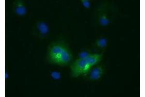 Anti-LIPG mouse monoclonal antibody (ABIN2453246) immunofluorescent staining of COS7 cells transiently transfected by pCMV6-ENTRY LIPG (RC209248). (LIPG antibody)