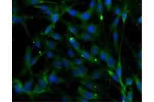 Immunofluorescent staining of C6 cells (Rat glioma, ATCC CCL-107) (right). (Phospholipase C beta 4 antibody  (AA 752-961))