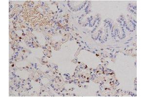 ABIN6267606 at 1/200 staining Rat lung tissue sections by IHC-P. (FAK antibody  (pTyr576))