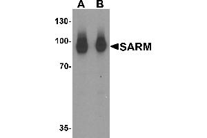 Western blot analysis of SARM in human kidney tissue lysate with SARM antibody at (A) 1 and (B) 2 µg/mL.
