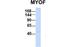 Host:  Rabbit  Target Name:  MYOF  Sample Type:  Human Fetal Brain  Antibody Dilution:  1.